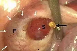 女人排卵照片,女性生理周期的奥秘瞬间